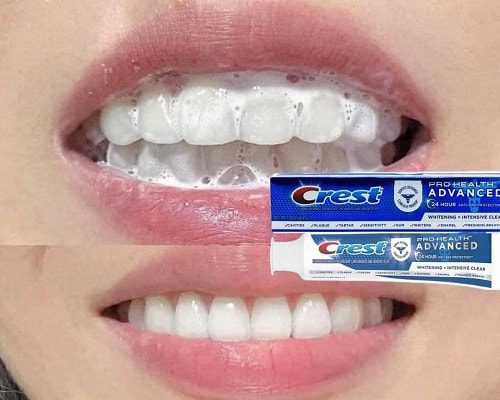 Kem đánh răng Crest Pro Health Advanced giá bao nhiêu?-2